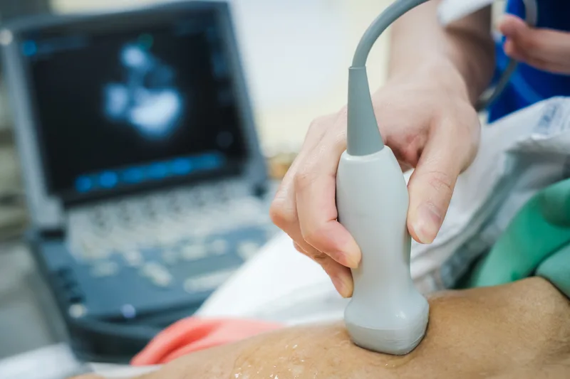 Cardiac echo imaging in progress