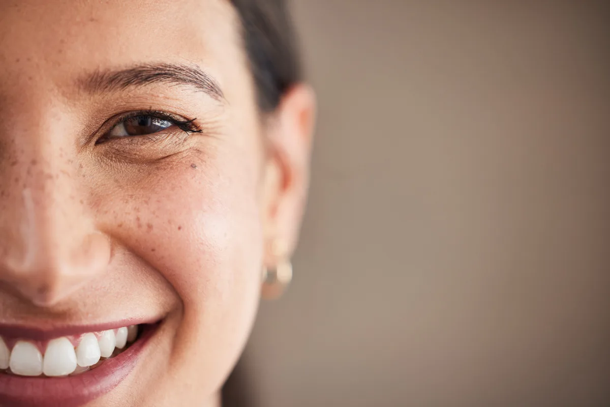 A bright, natural-looking smile after cosmetic treatment